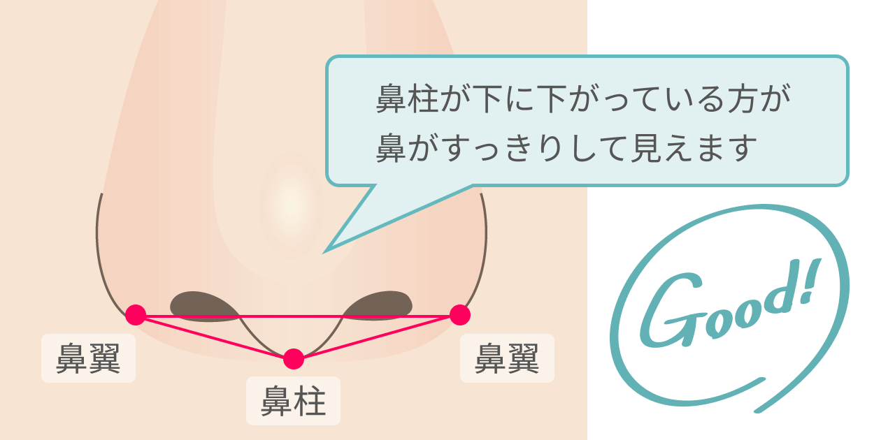 鼻柱が下に下がっている方が鼻がすっきりして見えます